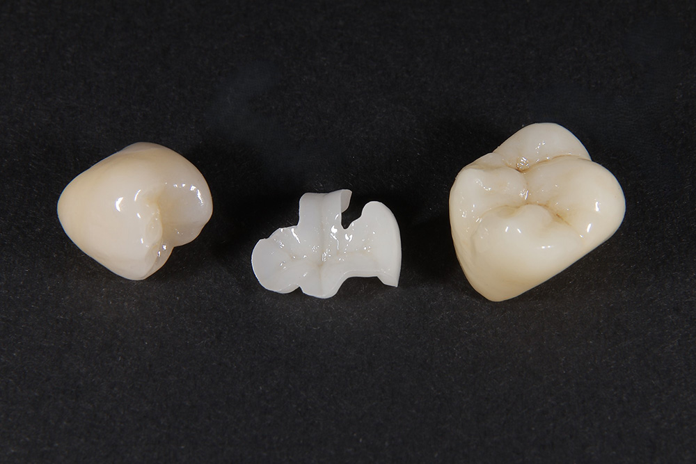 セラミック素材