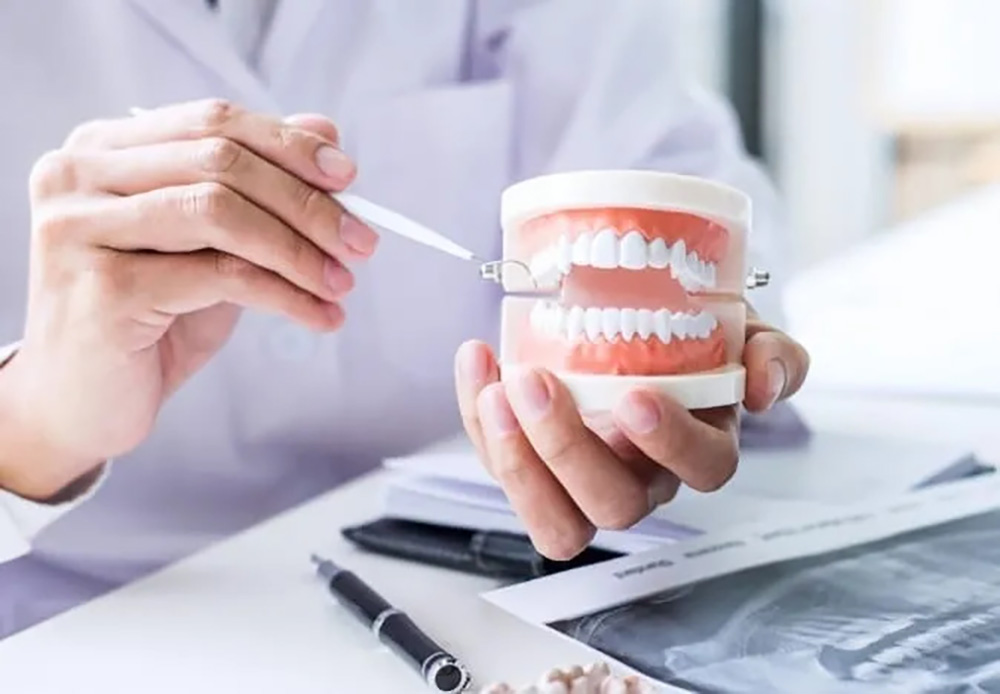 口腔内写真撮影