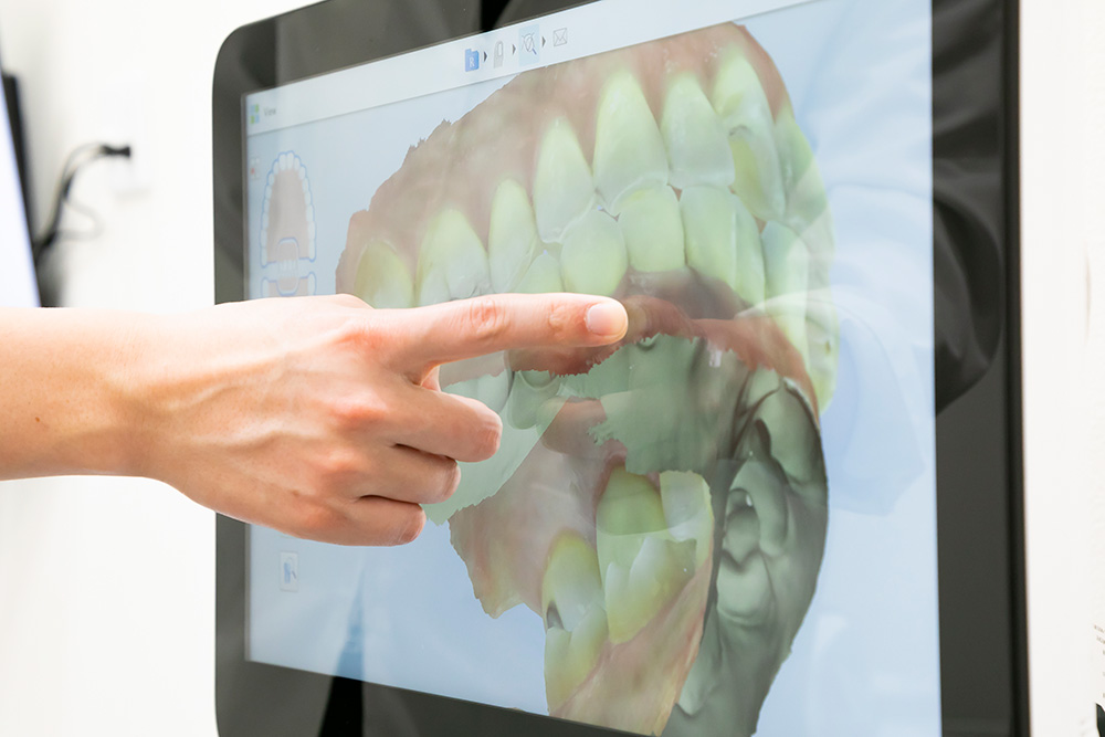 CTによる検査と治療計画