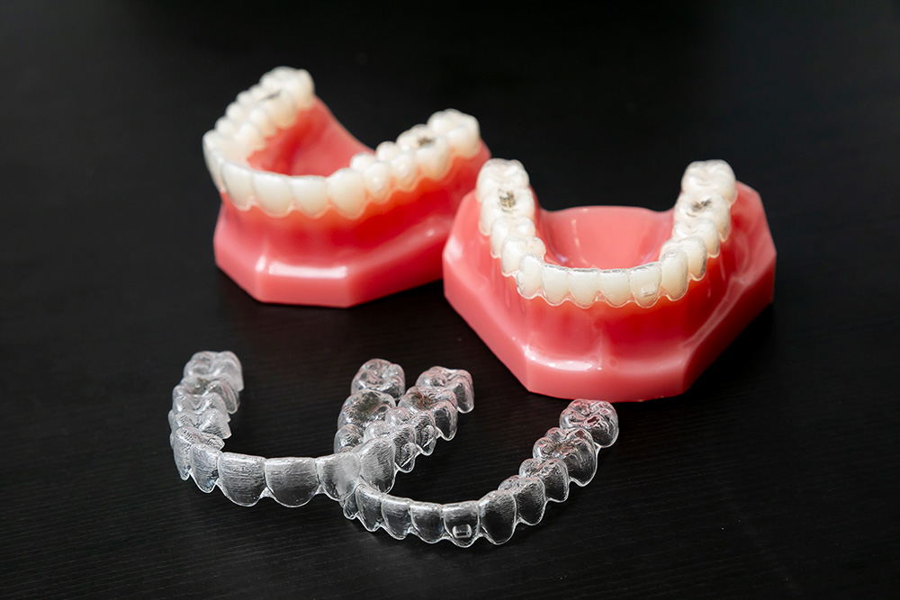 マウスピース矯正