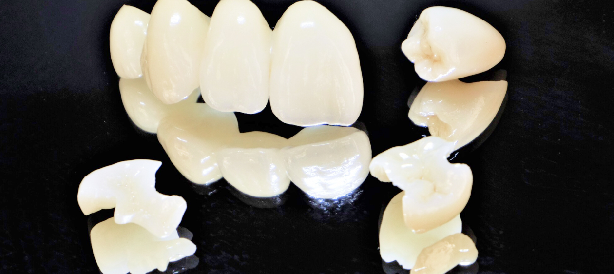 つめ物・かぶせ物